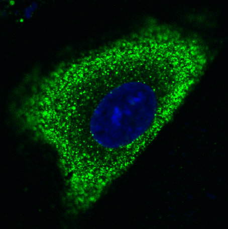miniatura DOKTOR. Rekrutacja do projektu SYMFONIA: Zewnątrzkomórkowa aktywność proteolityczna ludzkiego epitelium - rola w modulacji przekazu sygnału w obrębie nabłonka.